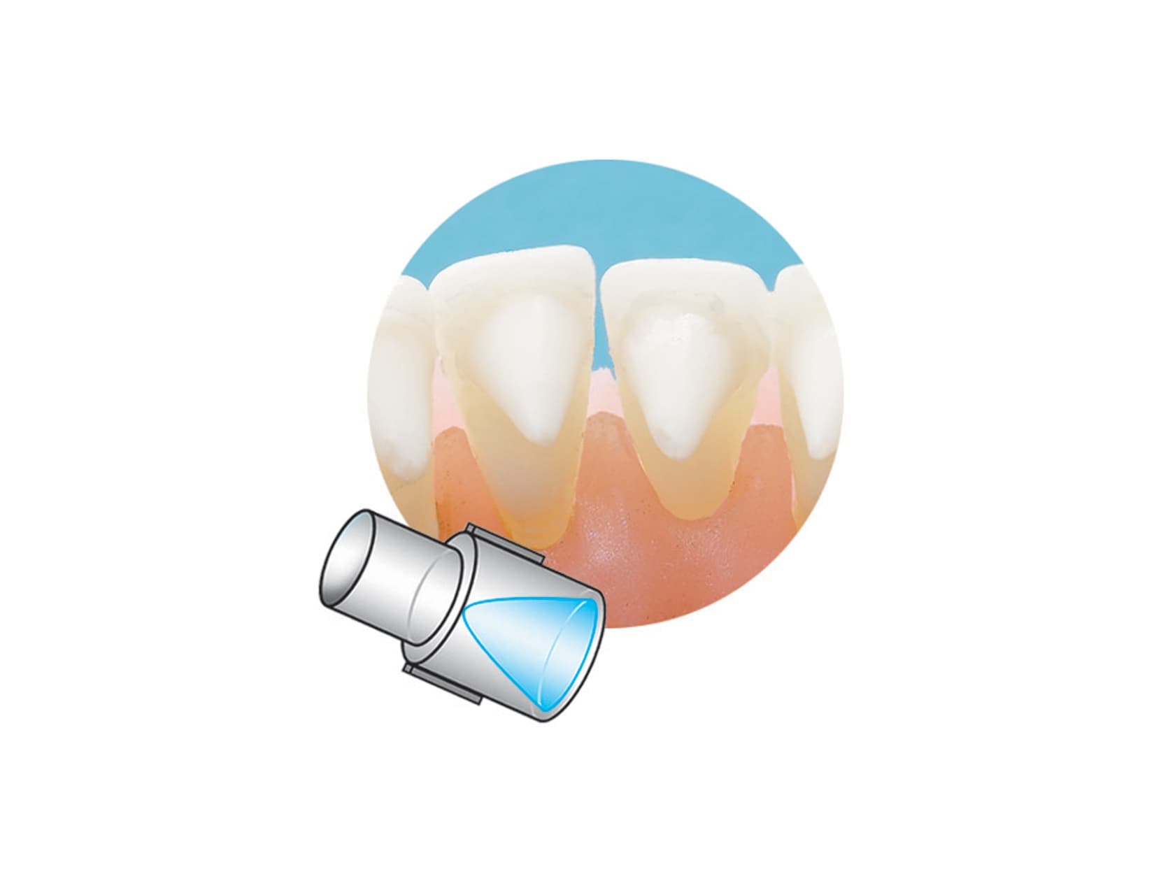 Attachements Mini Mold – pointes coniques