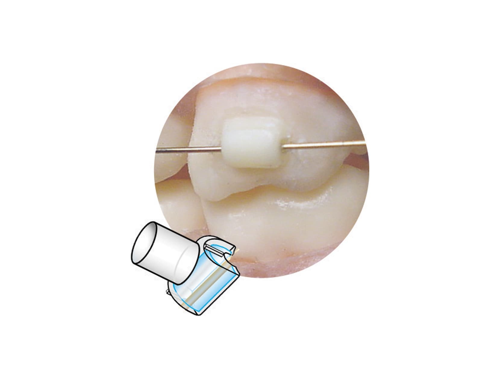 Attachements Mini Mold – tubes