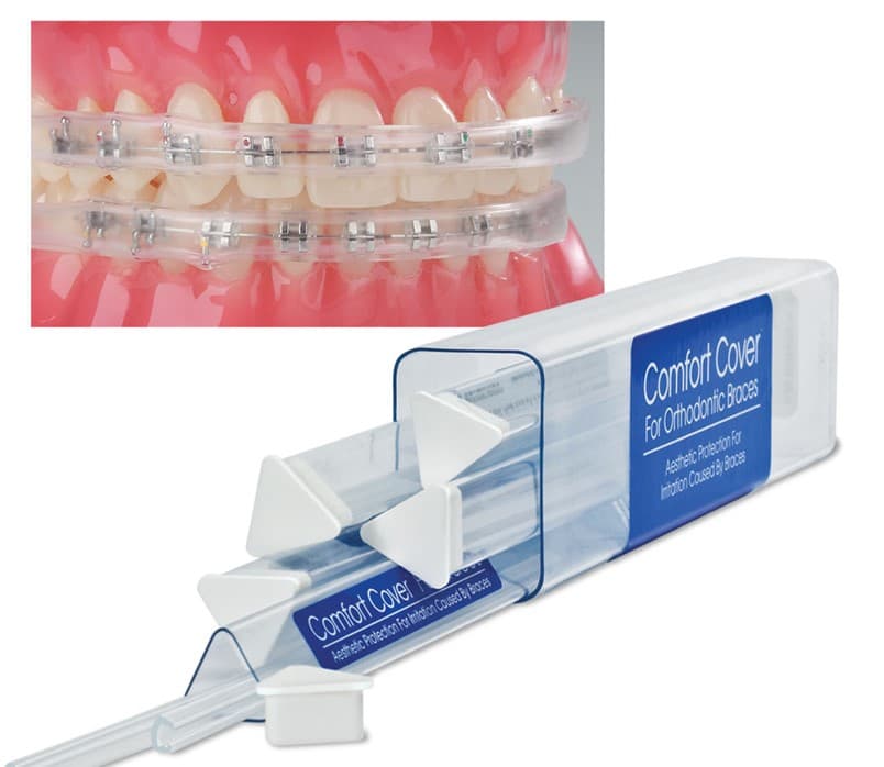 Protection orthodontique COMFORT COVER