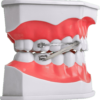 Système D-BAR